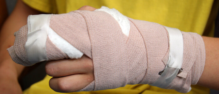 A man is wrapped in bandages from a burn